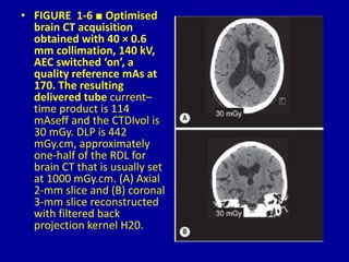 Ct Brain Collimation 1 Medical Physics Radiation Risk Garringer and Aliison Dr. Muhammad Bin ...