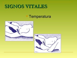 SIGNOS VITALESSIGNOS VITALES
 Temperatura
 
