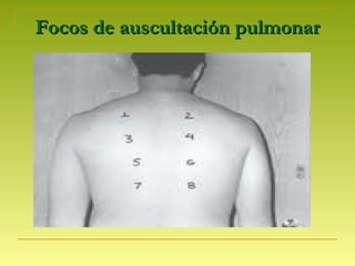 Focos de auscultación pulmonarFocos de auscultación pulmonar
 