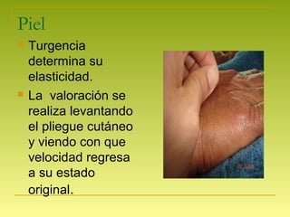 Piel
 Turgencia
determina su
elasticidad.
 La valoración se
realiza levantando
el pliegue cutáneo
y viendo con que
velocidad regresa
a su estado
original.
 