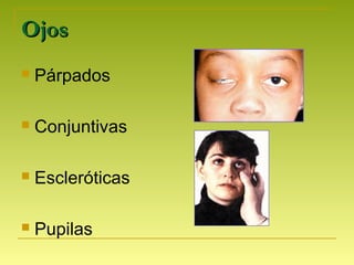 OjosOjos
 Párpados
 Conjuntivas
 Escleróticas
 Pupilas
 
