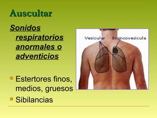 AuscultarAuscultar
Sonidos
respiratorios
anormales o
adventicios
 Estertores finos,
medios, gruesos
 Sibilancias
 