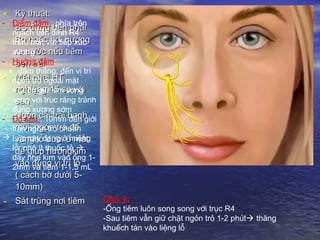 • Kỹ thuật:Kỹ thuật:
- BS đứng bên phảiBS đứng bên phải
Bn hoặc hơi hướngBn hoặc hơi hướng
ra trước nếu tiêmra trước nếu tiêm
bên tráibên trái
- Mặt nhai HTMặt nhai HT
nghiệng 45 so vớinghiệng 45 so với
sànsàn
- Ngón cái trái banhNgón cái trái banh
môi, ngón trỏ đểmôi, ngón trỏ để
vùng lỗ dưới ổ mắtvùng lỗ dưới ổ mắt
để giúp hướngkimđể giúp hướngkim
vào đúng vị trí lỗvào đúng vị trí lỗ
( cách bờ dưới 5-( cách bờ dưới 5-
10mm)10mm)
- Sát trùng nơi tiêmSát trùng nơi tiêm
- Điểm đâm : phía trên
ngách tiền đình R4
trên, mắt vát tiếp xúc
xương
- Hướng đâm:
+ đâm thẳng, đến vị trí
ngón trỏ ngoài mặt
+ Luôn giữ kim song
song với trục răng tránh
đụng xương sớm
- Độ sâu : 10mm đến giới
hạn ngón trỏ chuẩn
 Lúc này đang ở miệng
lỗ: nhỏ ít thuốc tê 
đẩy nhẹ kim vào ống 1-
2mm và tiêm 1-1,5 mL
Chú ý:
-Ống tiêm luôn song song với trục R4
-Sau tiêm vẫn giữ chặt ngón trỏ 1-2 phút thăng
khuếch tán vào liệng lỗ
 