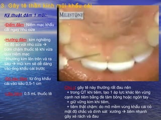 Kỹ thuật đâm 1 mũi:
-Điểm đâm: Niêm mạc khẩu
cái ngay nhú cửa
-Hướng đâm: kim nghiêng
45 độ so với nhú cửa 
bơm chậm thuốc tê khi vừa
qua niêm mạc
hướng kim lên trên và ra
sau  mũi kim sẽ dễ dàng
vào ống khẩu cái trước
-Độ sâu đâm: từ ống khẩu
cái vào sâu 0,5-1 cm
-Liều tiêm: 0,5 mL thuốc tê
Chú ý: gây tê này thường rất đau nên
+ trong QT khi tiêm, tạo 1 áp lực khác lên vùng
cạnh nơi tiêm bằng đè tăm bông hoặc ngón tay
+ giữ vững kim khi tiêm,
+ tiêm thật chậm: do mô mềm vùng khẩu cái có
mật độ chắc và dính sát xướng  tiêm nhanh
gây xé rách và đau
3. Gây tê thần kinh mũi khẩu cái
 