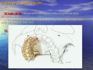 3. Gây tê TK khẩu cái lớn:3. Gây tê TK khẩu cái lớn:
Giải Phẫu:Giải Phẫu:
- TK khẩu cái lớnTK khẩu cái lớn: đi qua kênh chân bướm khẩu cái và đi vào khẩu: đi qua kênh chân bướm khẩu cái và đi vào khẩu
cái qua lỗ KC lớn.cái qua lỗ KC lớn.
 Chi phối cho khẩu cái từ vùng RCN đến KC mềm. Nằm cách viềnChi phối cho khẩu cái từ vùng RCN đến KC mềm. Nằm cách viền
nướu mặt trong R7 trên 1cm.nướu mặt trong R7 trên 1cm.
- TK khẩu cái béTK khẩu cái bé: từ lỗ KC bé, chi phối cho niêm mạc KC mềm và một: từ lỗ KC bé, chi phối cho niêm mạc KC mềm và một
phần vùng hạnh nhân KC.phần vùng hạnh nhân KC.
 