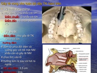Gây tê vùng cho toàn bộ dậy TK hàm trênGây tê vùng cho toàn bộ dậy TK hàm trên
• Kỹ thuật trong miệng:Kỹ thuật trong miệng:
b. tiếp cận từ ống khẩu cái lớn:b. tiếp cận từ ống khẩu cái lớn:
- Điểm chuẩnĐiểm chuẩn: lỗ khẩu cái lớn: lỗ khẩu cái lớn
- Điểm đếnĐiểm đến: hố chân bướm-: hố chân bướm-
KCKC
- Kỹ thuậtKỹ thuật::
++ điểm đâmđiểm đâm: như gây tê TK: như gây tê TK
Khẩu cái lớnKhẩu cái lớn
++hướng đâmhướng đâm::
# đâm từ phía đối diện và# đâm từ phía đối diện và
vuông góc với bề mặt NMvuông góc với bề mặt NM
khẩu cái và gây tê NMkhẩu cái và gây tê NM
# chọc tìm vào lỗ# chọc tìm vào lỗ
# hưỡng kim ra sau và hơi ra# hưỡng kim ra sau và hơi ra
ngoàingoài
++ Độ sâu đâmĐộ sâu đâm: 3,5 cm: 3,5 cm
 