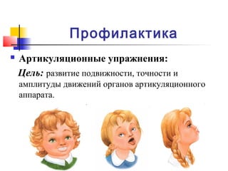 Профилактика
 Артикуляционные упражнения:
Цель: развитие подвижности, точности и
амплитуды движений органов артикуляционного
аппарата.
 