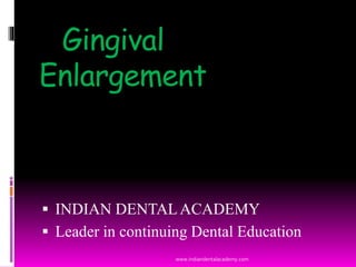 Gingival
Enlargement
 INDIAN DENTALACADEMY
 Leader in continuing Dental Education
www.indiandentalacademy.com
 