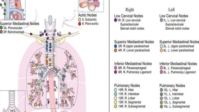 Radiological Anatomy Of Thoracic Lymph Nodes Ppt