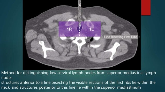 mediastinal lymph nodes