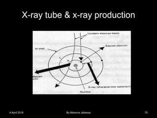 X-ray tube & x-ray production
4 April 2016 By Marema Jebessa 75
 