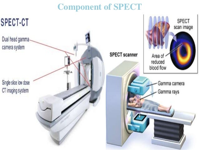 Spect Ct Scan Brain Ct Scan Machine Spect Ct Scan Brain Ct Scan Machine
