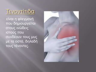 Τενοντίτιδα
είναι η φλεγμονή
που δημιουργείται
στους ινώδεις
ιστούς που
συνδέουν τους μυς
με τα οστά, δηλαδή
τους τένοντες.
 