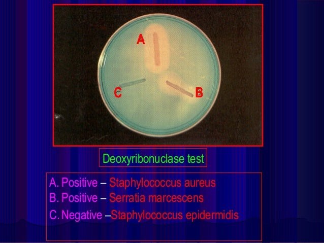 of composition urea tests (1st Biochemical part) of composition urea tests (1st Biochemical part)