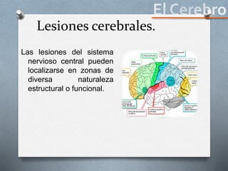 Lesiones cerebrales.
Las lesiones del sistema
nervioso central pueden
localizarse en zonas de
diversa naturaleza
estructural o funcional.
 
