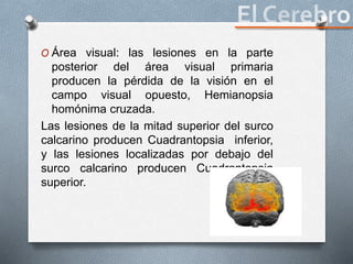 O Área visual: las lesiones en la parte
posterior del área visual primaria
producen la pérdida de la visión en el
campo visual opuesto, Hemianopsia
homónima cruzada.
Las lesiones de la mitad superior del surco
calcarino producen Cuadrantopsia inferior,
y las lesiones localizadas por debajo del
surco calcarino producen Cuadrantopsia
superior.
 