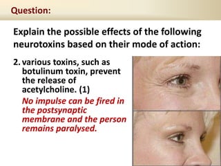 Explain the possible effects of the following
neurotoxins based on their mode of action:
Question:
2.various toxins, such as
botulinum toxin, prevent
the release of
acetylcholine. (1)
No impulse can be fired in
the postsynaptic
membrane and the person
remains paralysed.
 