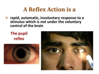 A Reflex Action is a
 rapid, automatic, involuntary response to a
stimulus which is not under the voluntary
control of the brain
The pupil
reflex
 