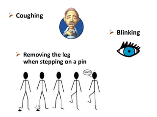  Blinking
 Coughing
 Removing the leg
when stepping on a pin
 