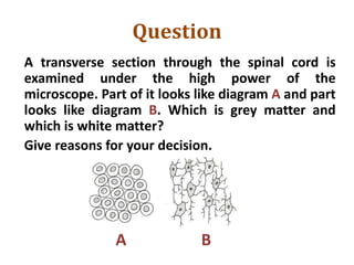 Question
A transverse section through the spinal cord is
examined under the high power of the
microscope. Part of it looks like diagram A and part
looks like diagram B. Which is grey matter and
which is white matter?
Give reasons for your decision.
A B
 