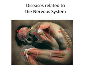 Diseases related to
the Nervous System
 