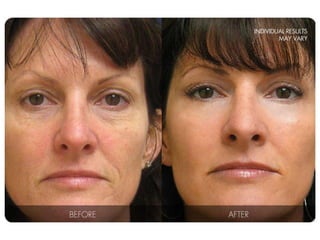 Coordination & Response Part 1 - The Nervous System