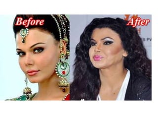 Coordination & Response Part 1 - The Nervous System