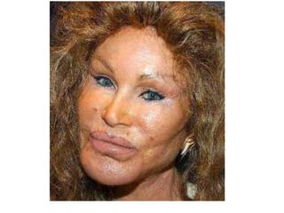 Coordination & Response Part 1 - The Nervous System