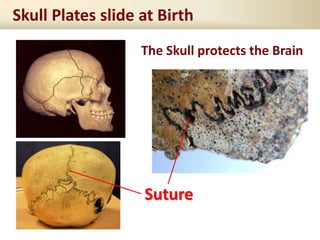 Skull Plates slide at Birth
Suture
The Skull protects the Brain
 