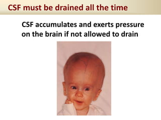 CSF must be drained all the time
CSF accumulates and exerts pressure
on the brain if not allowed to drain
 