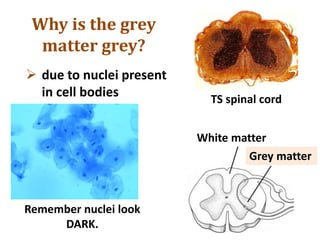 Grey matter
White matter
 due to nuclei present
in cell bodies TS spinal cord
Remember nuclei look
DARK.
Why is the grey
matter grey?
 