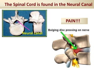 The Spinal Cord is found in the Neural Canal
Neural canal
PAIN!!!
 