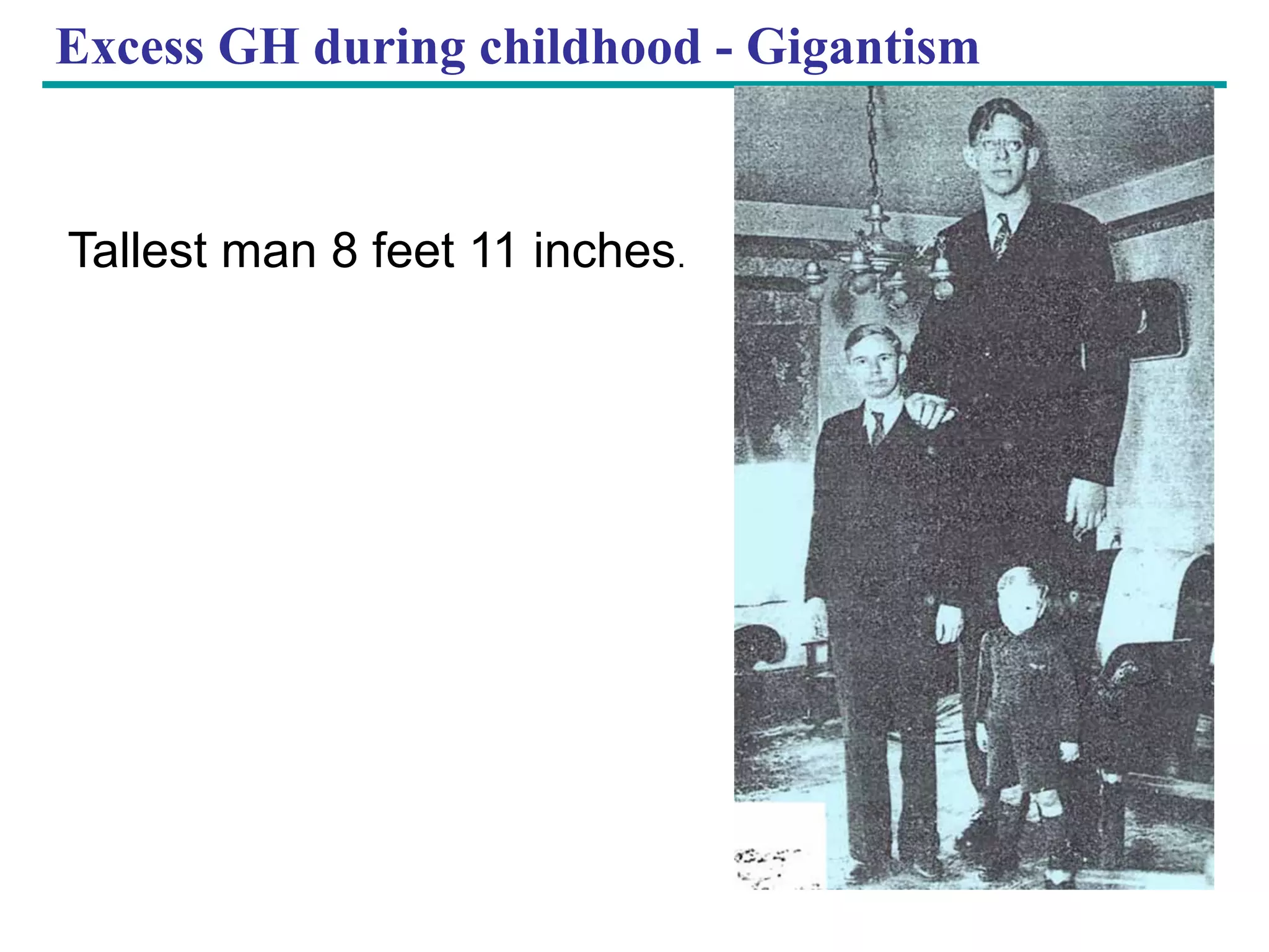 Copyright © 2005 Pearson Education, Inc. publishing as Benjamin Cummings
Excess GH during childhood - Gigantism
Tallest man 8 feet 11 inches.
 