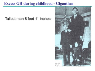 Copyright © 2005 Pearson Education, Inc. publishing as Benjamin Cummings
Excess GH during childhood - Gigantism
Tallest man 8 feet 11 inches.
 
