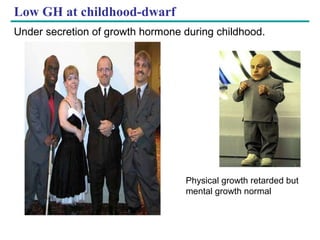 Copyright © 2005 Pearson Education, Inc. publishing as Benjamin Cummings
Low GH at childhood-dwarf
Under secretion of growth hormone during childhood.
Physical growth retarded but
mental growth normal
 