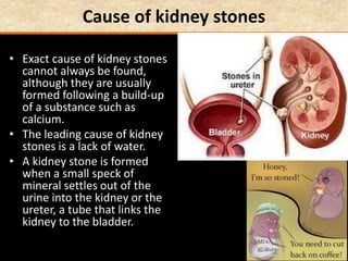 Cause of kidney stones
• Exact cause of kidney stones
cannot always be found,
although they are usually
formed following a build-up
of a substance such as
calcium.
• The leading cause of kidney
stones is a lack of water.
• A kidney stone is formed
when a small speck of
mineral settles out of the
urine into the kidney or the
ureter, a tube that links the
kidney to the bladder.
 