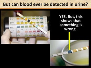 But can blood ever be detected in urine?
YES. But, this
shows that
something is
wrong .
 