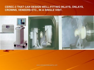 AN OVERVIEW OF THE CEREC 3D CAD/CAM SYSTEM / dental implant courses by ...