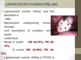 Evidence -based Management of PCOS | PDF