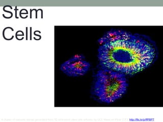 Stem
Cells
A cluster of nascent retinae generated from 3D embryonic stem cell cultures, by UCL News on Flickr (CC): http://flic.kr/p/ffPBPT
 