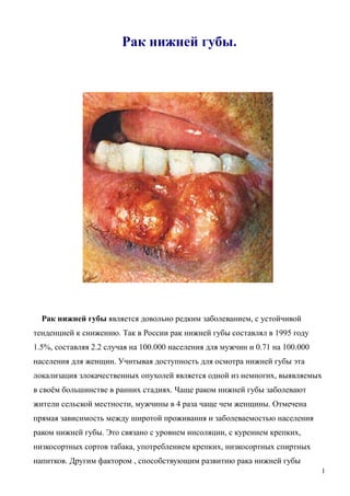 Рак нижней губы.
Рак нижней губы является довольно редким заболеванием, с устойчивой
тенденцией к снижению. Так в России рак нижней губы составлял в 1995 году
1.5%, составляя 2.2 случая на 100.000 населения для мужчин и 0.71 на 100.000
населения для женщин. Учитывая доступность для осмотра нижней губы эта
локализация злокачественных опухолей является одной из немногих, выявляемых
в своём большинстве в ранних стадиях. Чаще раком нижней губы заболевают
жители сельской местности, мужчины в 4 раза чаще чем женщины. Отмечена
прямая зависимость между широтой проживания и заболеваемостью населения
раком нижней губы. Это связано с уровнем инсоляции, с курением крепких,
низкосортных сортов табака, употреблением крепких, низкосортных спиртных
напитков. Другим фактором , способствующим развитию рака нижней губы
1
 