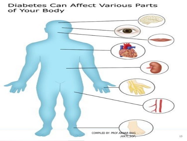 Kidney Disease Nephropathy American Diabetes Association