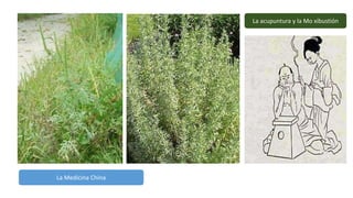 La acupuntura y la Mo xibustión
La Medicina China
 