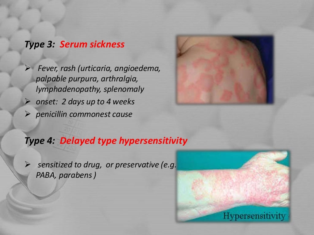 1.Antibiotics and analgesics in pediatric dentistry