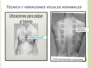 TÉCNICA Y VIBRACIONES VOCALES NORAMALES
INFRACLAVICULAR
ESCAPULO
VERTEBRAL
 