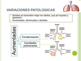 VARIACIONES PATOLOGICAS
 Sonidos se transmiten mejor los sólidos, que por líquidos y
gaseosos.
 Aumentadas, disminuidas o abolidas
Aumentadas
Condensación
Cavidades
pulmonares
 