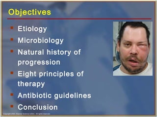 Copyright 2003, Elsevier Science (USA). All rights reserved.
Objectives
 Etiology
 Microbiology
 Natural history of
progression
 Eight principles of
therapy
 Antibiotic guidelines
 Conclusion
 