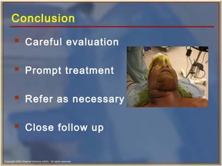 Copyright 2003, Elsevier Science (USA). All rights reserved.
Conclusion
 Careful evaluation
 Prompt treatment
 Refer as necessary
 Close follow up
 