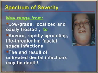 Copyright 2003, Elsevier Science (USA). All rights reserved.
Spectrum of Severity
May range from:
Low-grade, localized and
easily treated , to
Severe, rapidly spreading,
life-threatening fascial
space infections
The end result of
untreated dental infections
may be death!
 