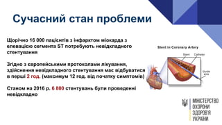 Щорічно 16 000 пацієнтів з інфарктом міокарда з
елевацією сегмента ST потребують невідкладного
стентування
Згідно з європейськими протоколами лікування,
здійснення невідкладного стентування має відбуватися у
в перші 2 год. (максимум 12 год. від початку симптомів)
Станом на 2016 р. 6 800 стентувань були проведенні
невідкладно
Сучасний стан проблеми
 